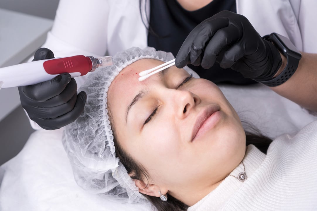 Micro Needle Mesotherapy. Derma Pen